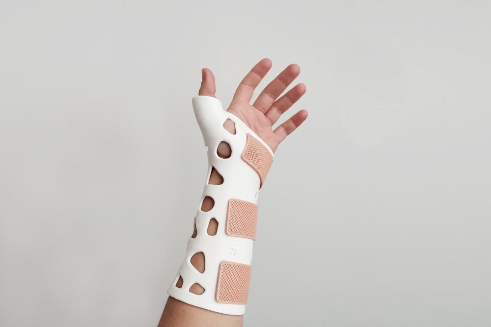 Ferula3d_DeQuervain1 Férula 3d De Querivain