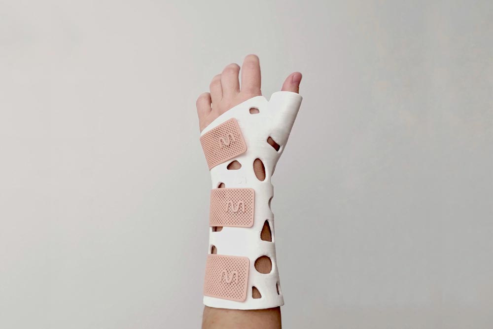 Ferula3d_DeQuervain3 Férula inmovilización de Quervain