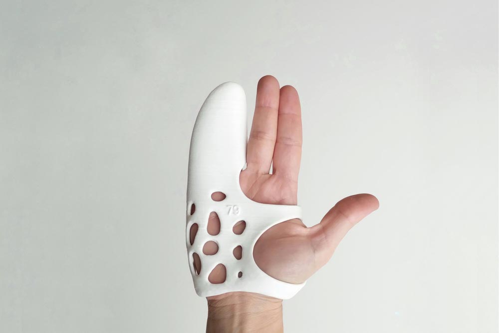 Ferula3d_Dupuytren_1 Férula 3D Dupuytren ortopedia almoradi