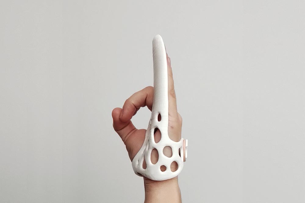 Ferula3d_Dupuytren_3 Contractura Dupuytren férula 3d