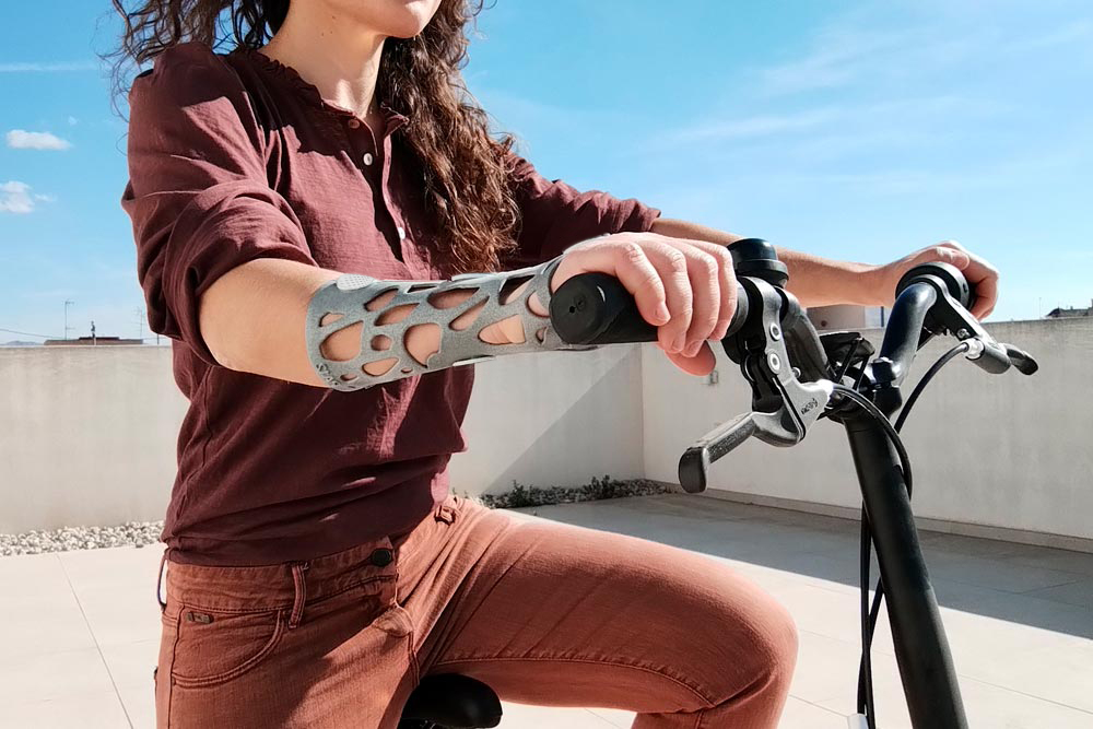 ferula3d_muneca2b2 Lesión muñeca ortopedia