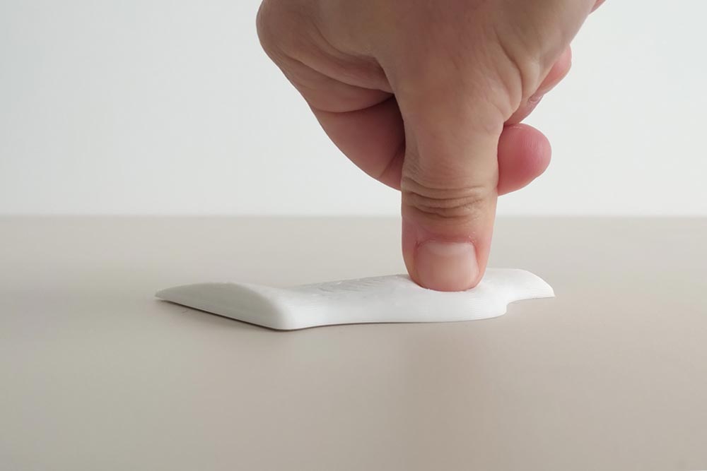 Plantillas3d_sesamoiditis3 ortopedia 3d