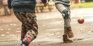 Diseño y ortopedia, más allá de la funcionalidad Niño prótesis femoral