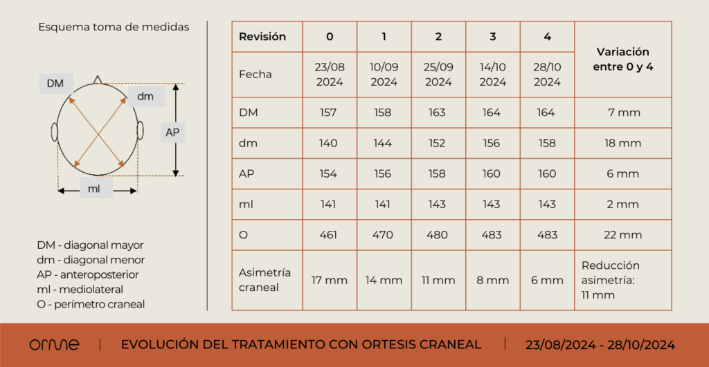 Evolucion tratamiento plagiocefalia