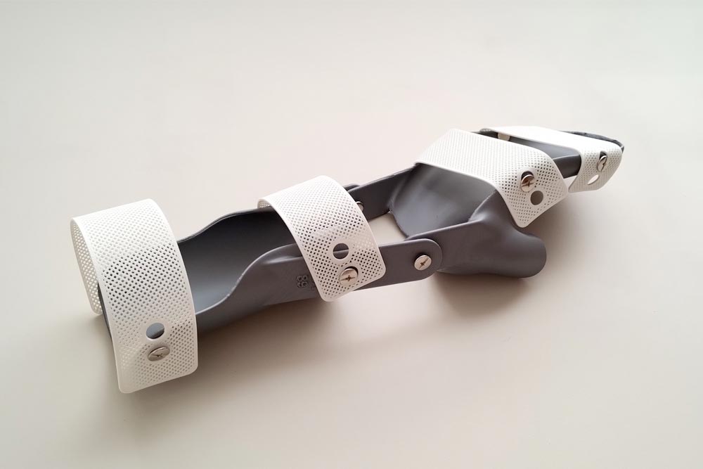 ArtiMuneca_2 Férula 3d