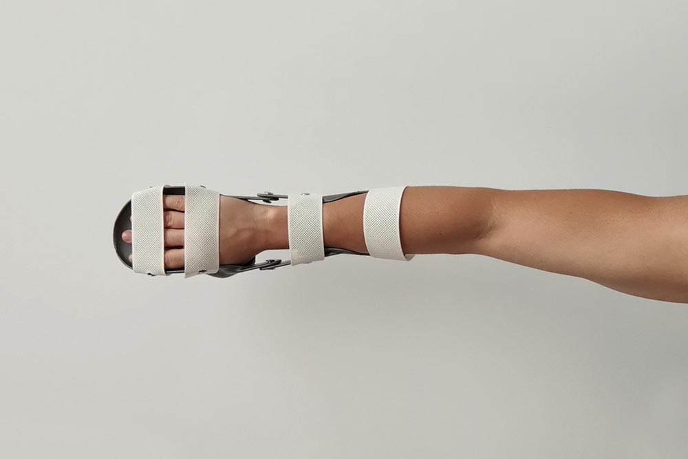 ArtiMuneca_3 Férula de muñeca