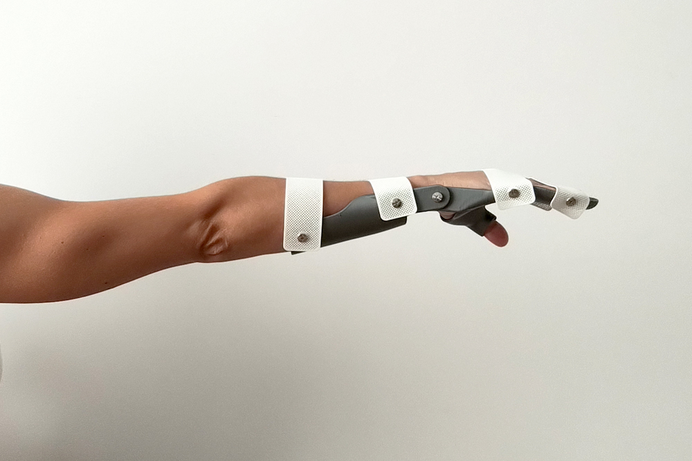 ArtiMuneca_4 Férula para rehabilitación