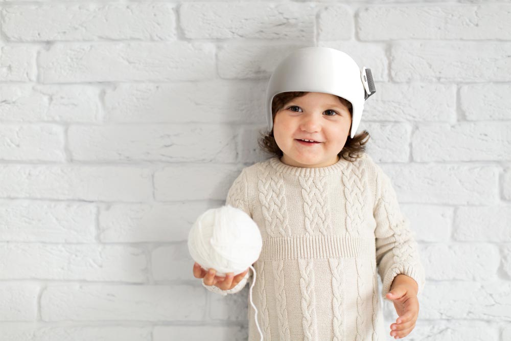 CascoPlagio1 Casco plagiocefalia