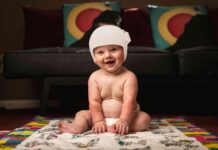 Caso de éxito. Resultados del tratamiento con ortesis craneal caso éxito casco plagiocefalia